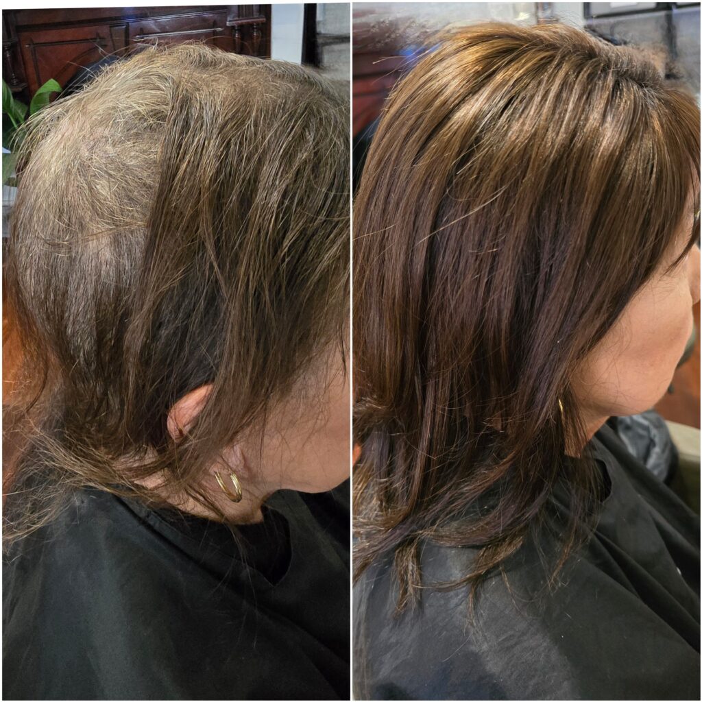 Hair topper before and after photo, Custom Hair Company
