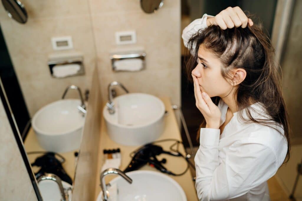 worried woman showing alopecia hair loss in mirror