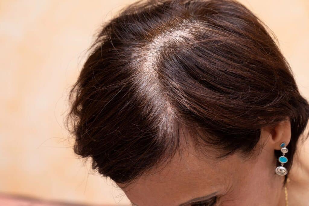 woman showing thinning hair
